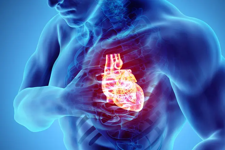 Cardiac Arrest
