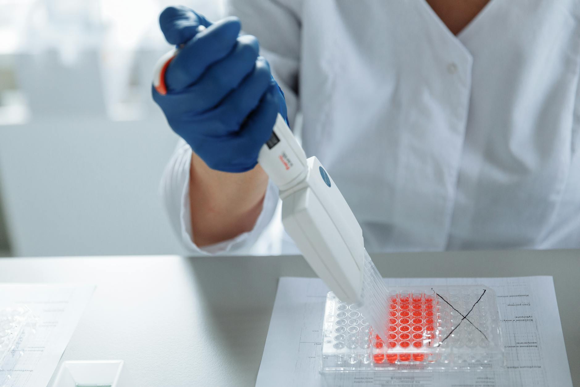 Type 1 diabetes cure Stanford Type 1 diabetes cure Stanford
